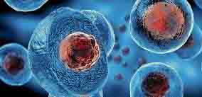 درمان ارتروز مفاصل با سلول های بنیادین
