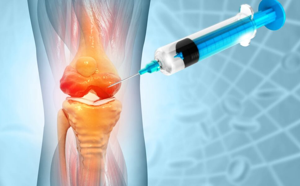 Platelet-rich plasma